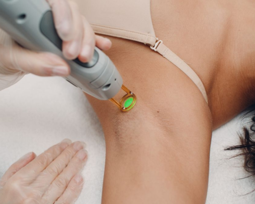 Underarm Laser Hair Removal Mysore